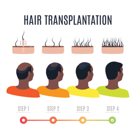 Afro-textured hair transplantation surgery steps infographics. African male patient getting hair loss treatment with FUT, FUE methods. Treating alopecia medical poster. Vector illustration.のイラスト素材