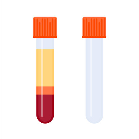Laboratory tube rack with PRP blood collection tubings after separation of platelets in the centrifuge. Platelet-rich plasma regenerative medicine concept. PRP vector infographics.のイラスト素材