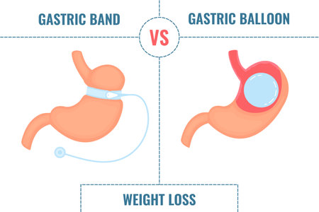 Adjustable gastric band vs gastric balloon. Bariatric surgery weight loss procedures comparison. Stomach reduction anatomical diagram infographics. Health care medical concept. Vector illustration.のイラスト素材