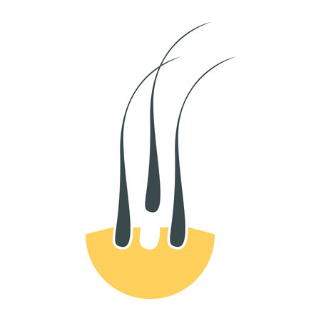 Hair transplant follicle grafts icon. Alopecia treatment for medical diagnostic centers and clinics. Baldness concept. Vector illustration.のイラスト素材