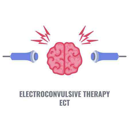 Electroconvulsive therapy for severe depression and schizophrenia treatment. ECT electrodes placement. Brain stimulation equipment for bipolar and major depressive disorders. Vector illustration.のイラスト素材