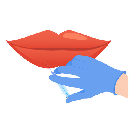 Lip dermal filler plumping injection for volume enhancement. Mouth cosmetic treatment of contouring and reshaping correction. Rejuvenation beauty concept. Flat vector illustration isolated on white.のイラスト素材