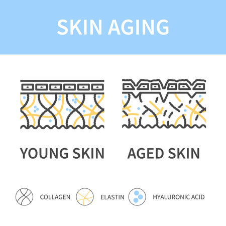Young skin versus aged skin cross section diagram. Firm skin becoming saggy with low levels of collagen, elastin and hyaluronic acid. Linear vector illustration.のイラスト素材