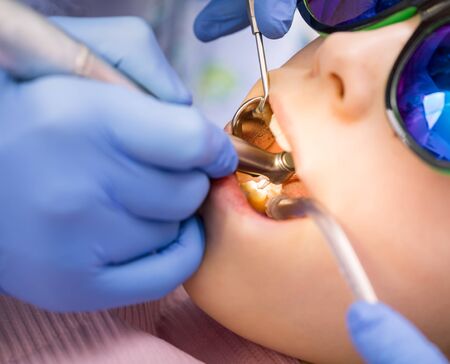 Dentist performing dental filling procedure to preteen girl in pediatric dental clinic. Doctor...