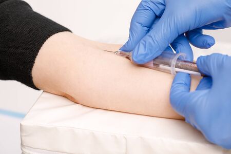 Close-up shot of doctor or nurse taking a blood sample from arm vein with a vacutainer. Venipuncture or venepuncture procedureの写真素材
