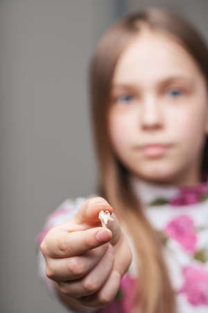 Elementary age girl showing extracted baby tooth with caries in dental clinic - bad oral hygiene...