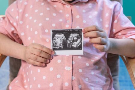 Pregnant woman holding ultrasound image. Concept of pregnancy, health care, gynaecology, medicine. Young mother waiting of the baby. Close-up, copy space, indoors.の写真素材