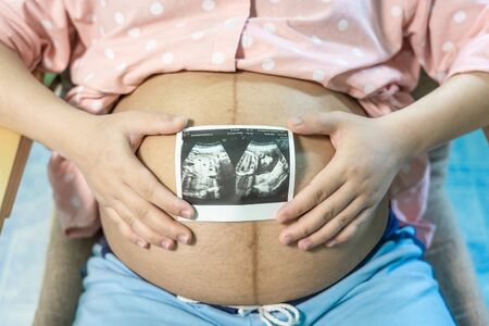 Pregnant woman holding ultrasound image. Concept of pregnancy, health care, gynaecology, medicine. Young mother waiting of the baby. Close-up, copy space, indoors.の写真素材
