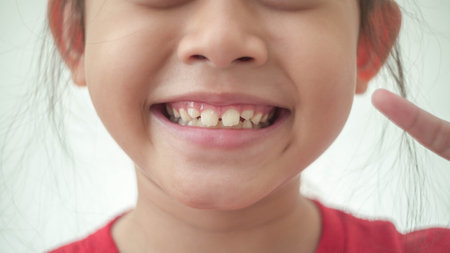 Happy Asian child in red showing her decayed teeth in selective focusの写真素材