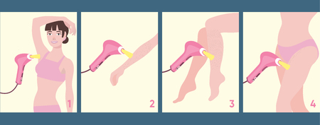 Scheme showing zone for IPL epilator applying: armpit, arm, legs, bikini zoneのイラスト素材