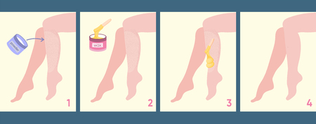 Scheme of how applying hot wax or sugaring. Illustration shows steps of applying this method to delete unwanted hair.のイラスト素材