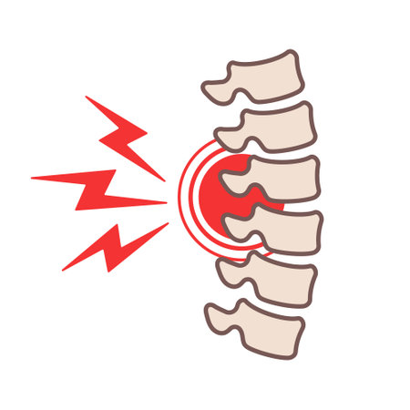 Back pain icon in line and fill style.のイラスト素材