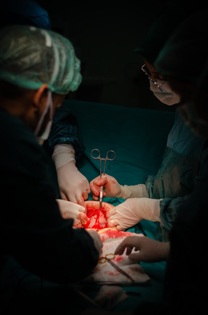 Abdominal rectus muscle has been disseceted by the team to reach uterusの写真素材