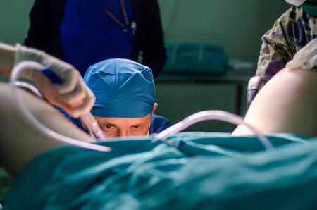 Surgeon doctor in operating room during gynecological biopsyの写真素材
