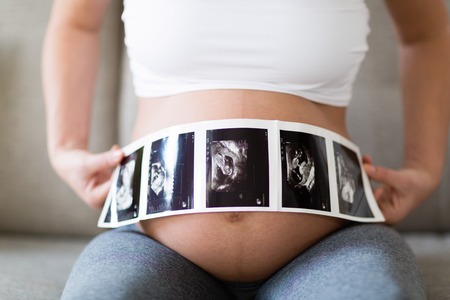 Pregnant woman holding ultrasound photo on belly