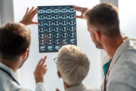 Group of doctor looking at ct, mri scan at hospital to make diagnosisの写真素材