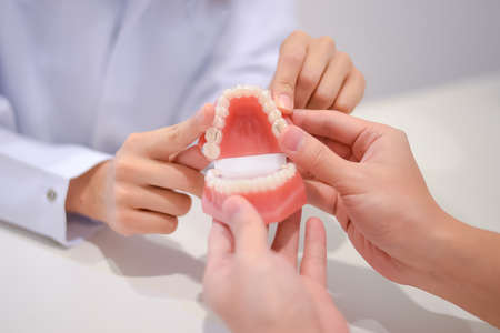 Dentest explaining to patient  about prosthesis dentures processの写真素材