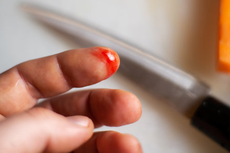 finger cut in the kitchen. Male finger with a wound and blood on a blurred background of a kitchen knife.の写真素材