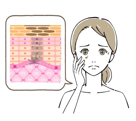 Illustration of Women's Faces, Beauty Concernsのイラスト素材