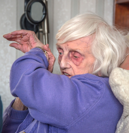 A blind 90 year old lady,with severe macular de-generation can only tell the time by listening to her talking watch.の写真素材
