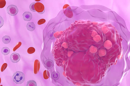 Acute lymphoblastic leukemia (ALL) cancer cells in the blood flow - closeup view 3d illustration