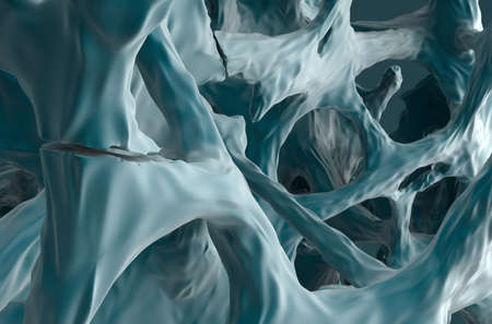 Fracture bones in osteoporosis - isometric left view 3d illustration
