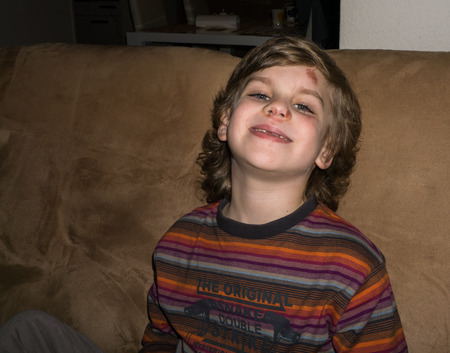 boy with bruise and scratch on the faceの写真素材