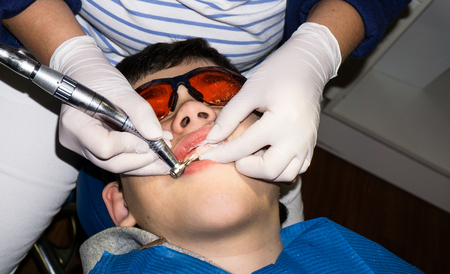 boy in dental treatment. brace. health careの写真素材