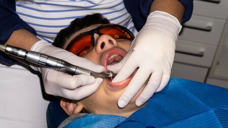 boy in dental treatment. brace. health careの写真素材