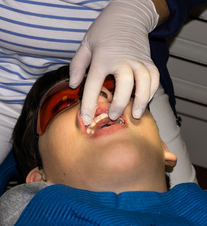 boy in dental treatment. brace. health careの写真素材