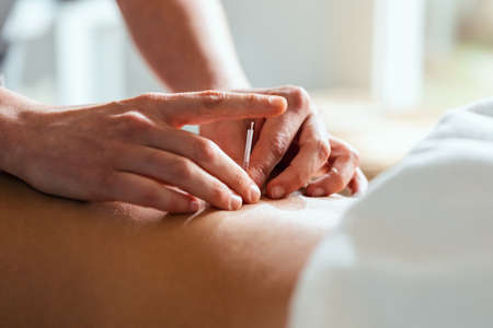 Close-up of young physiotherapist doing a trigger point injection in patient back.の写真素材