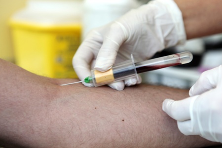 Blood Sugar Testの写真素材