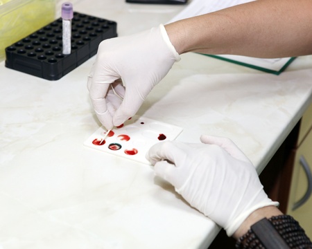 Blood Sugar Testの写真素材