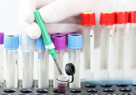 Image of Coronavirus disease (COVID-19) test for new vaccine