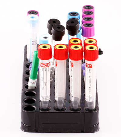 Burgas, Bulgaria - September 24, 2010: Instruments used in hospital laboratories. Laboratory blood...