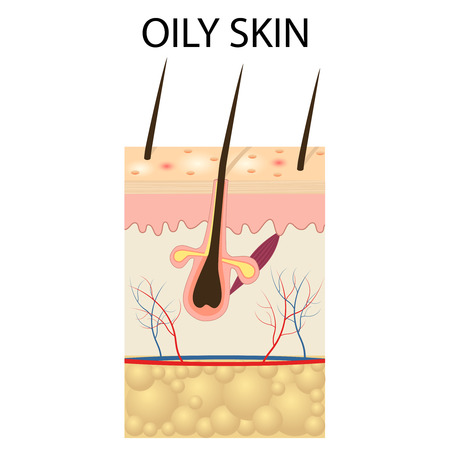 Illustration of The layers of oily skin on the white background.のイラスト素材