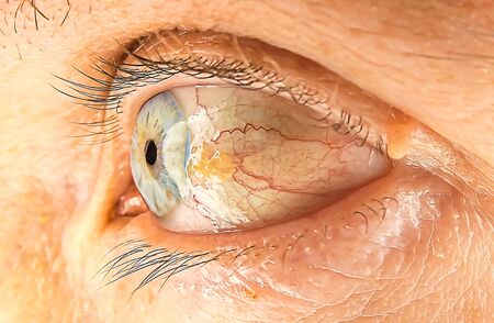 Macro photography of a blue male eyeの写真素材