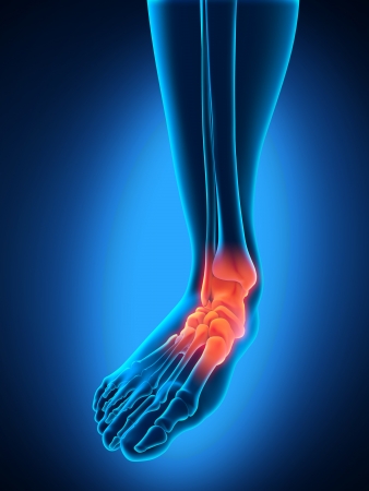 Painful Footの写真素材