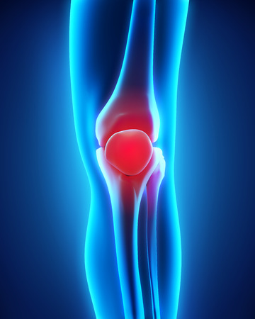 Painful Knee Illustrationの写真素材