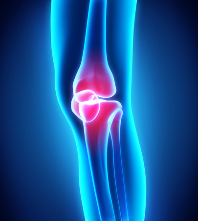 Painful Knee Illustrationの写真素材
