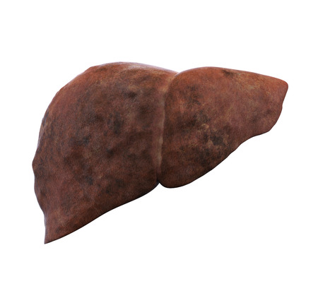 Unhealthy Liver Anatomy Isolatedの写真素材
