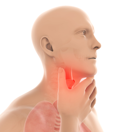 Sore Throat Illustrationの写真素材