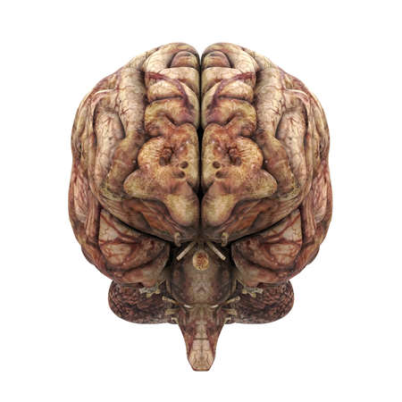 Unhealthy Human Brain Anatomy Isolatedの写真素材