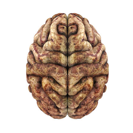 Unhealthy Human Brain Anatomy Isolatedの写真素材