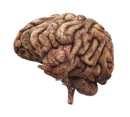 Unhealthy Human Brain Anatomy Isolatedの写真素材