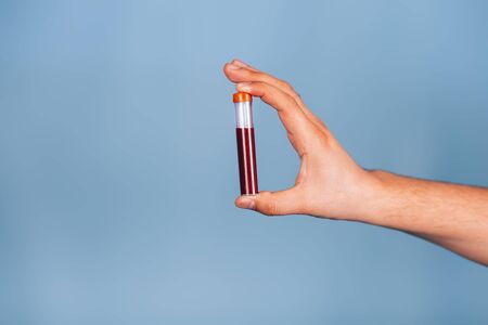 The doctor holds in his hands a test tube with bloodの写真素材