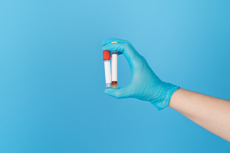 Hand holding two test tubes with stickers for text