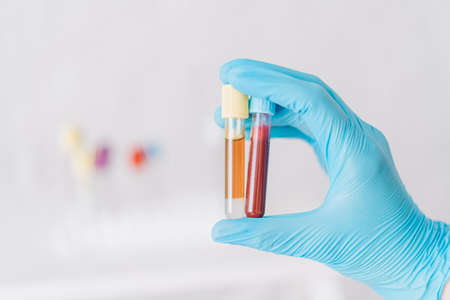 Hand holding two test tubes with blood and plasma against the background of vialsの写真素材