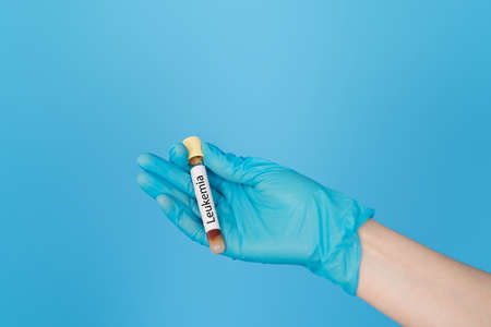 Hand holding test tube of blood with the inscription leukemia