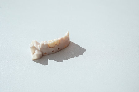 Top View Teeth Crowns, Bridge Dental Equipment Model For Tooth Restoration. Inserting Or Placing...